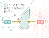 シリコンの部分だけ表皮まで体温が届かない。