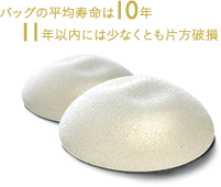 バッグの平均寿命は10年 11年以内には少なくとも片方破損