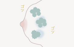 ゴツゴツ