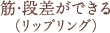 筋・段差ができる（リップリング）
