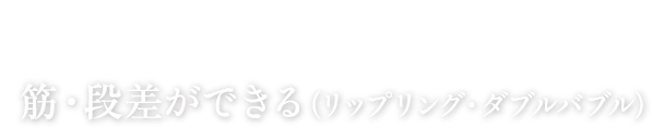 豊胸のよくある失敗 No.8 筋・段差ができる（リップリング・ダブルバブル）