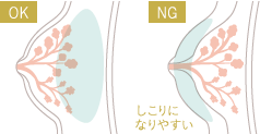 しこりになりやすい