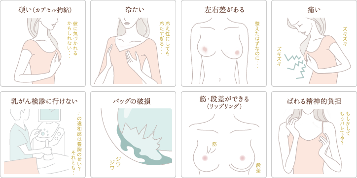 豊胸のよくある失敗ベスト10
