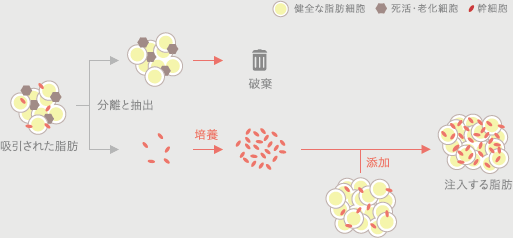 セルチャー豊胸の注入脂肪の作り方