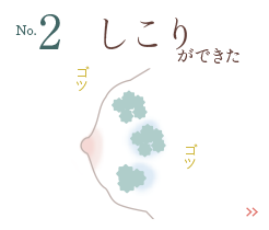 しこりができた